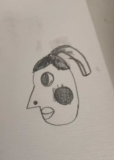 Understanding Hyperpigmentation and Its Artistic Expression