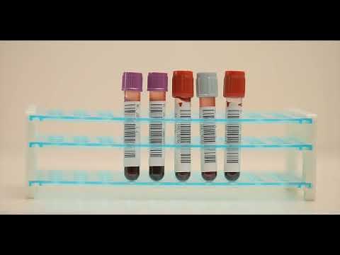 Mispa Label - Automatic Tube labelling System for Hospitals and Laboratories