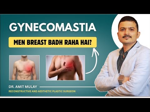 Gynecomastia Explained | Causes, Symptoms & Treatment | Dr. Amit Mulay
