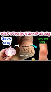 Skin care tips #Viral #viralreels #Viralvideo #Richa Tips | Richa Tips and Recipe