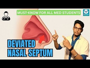 Deviated Nasal Septum (DNS) Explained | Etiology, Types & Treatment | By Manjeet #ENTLecture #nose