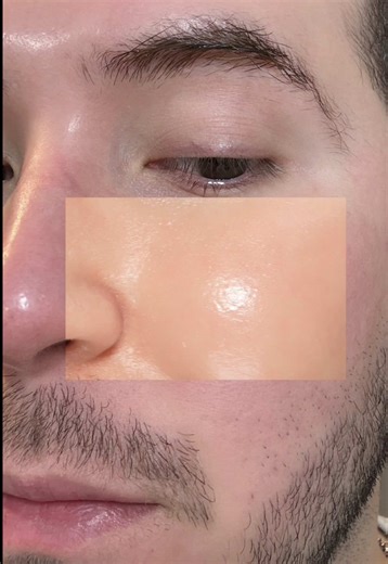 Say goodbye to guesswork and hello to a skin reset you can feel! I’ve been loving the @SKIN1004 US Probio-Cica Enriched Cream, and this video shows exactly why it’s become non-negotiable in my routine. This cream isn’t just another moisturizer, it’s a barrier-boosting, hydration-locking, sensitivity-soothing powerhouse designed for skin that feels thin, irritated, or dehydrated. Why I’m obsessed: - Strengthens the skin barrier with probiotics cica - Deep, lasting hydration – no greasy finish - C