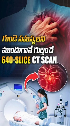 First 640-Slice CT Scan in Hyderabad | Advanced Heart Care | Medicover Hospitals |