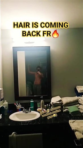 (check the comments) my hair is growing back fr #fat #overweight #toji