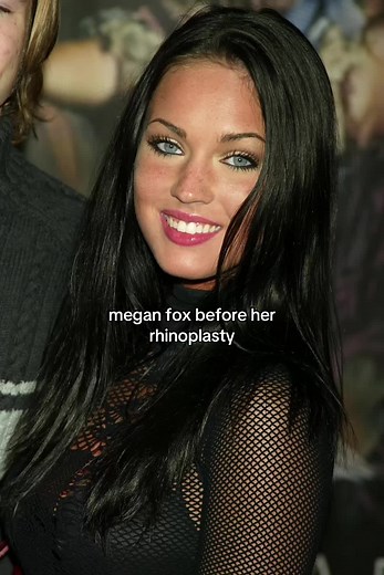 Megan Fox Before and After Surgery Transformation Revealed