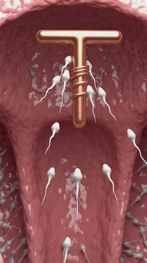 copper t kaise rokta ha pregnancy 3d animation #3danimation #viral #viralshorts