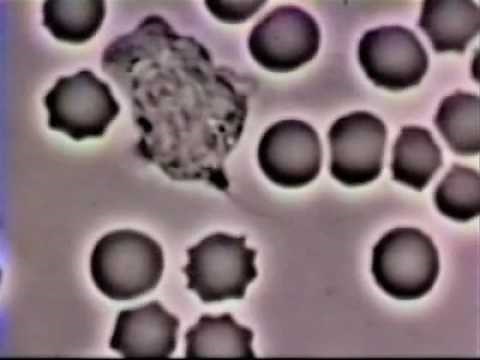 Neutrophil Phagocytosis