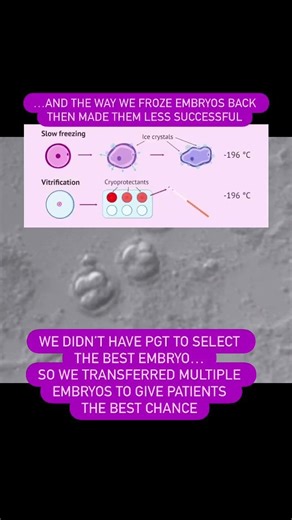 How IVF has changed since the 1990s: safer, smarter, more successful