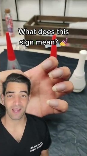 Clubbed Fingers