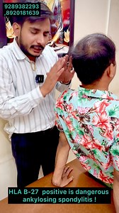 39K views · 348 reactions | HLA B-27 positive is dangerous ankylosing spondylitis ! #ankylosingspondylitis #spondyloarthriti #asawareness #ChronicBackPain #spinalstenosis #fullbodypain | Raje Kaushik | Facebook