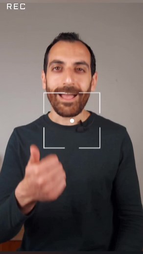 أغلبنا يعاني من الحساسية ولكن هل تعلمون ما هي؟🤧. . . #hits #explore #trends #scientificcontent #contentcreator #eye #opticalshops #allergy #حساسية #عين #عيون #محتوى_تعليمي #محتوى_هادف