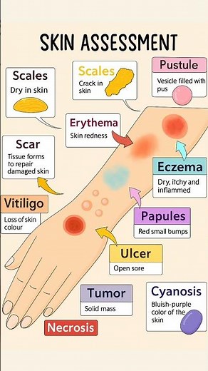 🩺 Skin Assessment Guide — Recognizing Common Skin Conditions:#SkinAssessment #Dermatology #Nursing