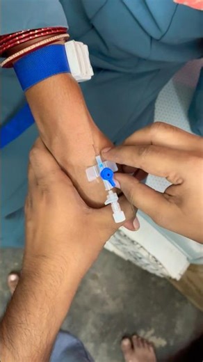 Iv cannulation process