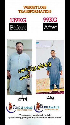 Struggling with obesity and feeling uncomfortable? Consider bariatric surgery to improve your life. It's a safe, laparoscopic procedure with no complications. Don't wait any longer—stop the stress and contact us . #weightloss #bariatricsurgery #opportunities #healthylifestyle #surgeon