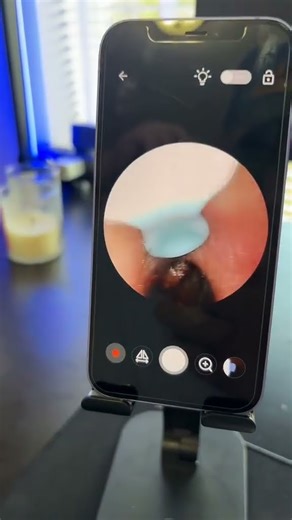 Just search: Q96991 ClearView Aural #TrendingProducts