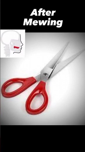 Mewing transformation