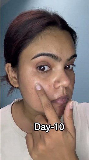 ✨ Best Serum for Glowing Skin? Honest Review!