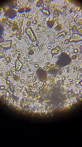 2.3K views · 26 reactions | This reel shows microorganisms magnified...