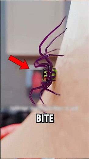 If You Ever Get Bitten by a Spider, DO THIS! 🕷️