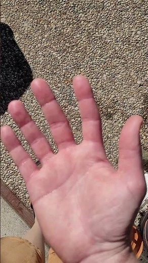 Involuntary Hand Movement Part 1