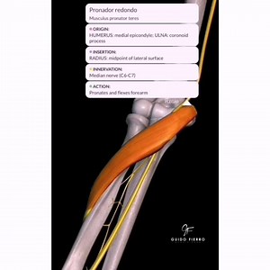34K views · 104 reactions | Relación del músculo pronador redondo (Pronator Teres) con el nervio mediano. #pronatorteres #pronadorredondo #elbowanatomy #anatomiadecodo #mediannerve #nerviomediano #síndromedepronador #sindromedelpronador #pronatorteressyndrome | Cirugía de Hombro y Codo | Facebook