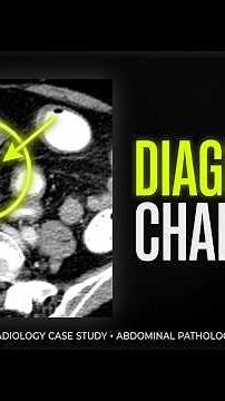 Abdominal Pain & Watery Diarrhea | Gastrointestinal Case 44
