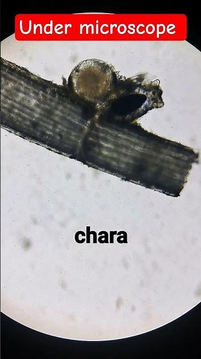 Microscopic View of Chara 🌿 | Green Algae with Node & Internode #biocrackwithranjan #algae #biology