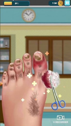 SCREAMING WHILE OPERATING! - Foot Surgery Sim Gameplay