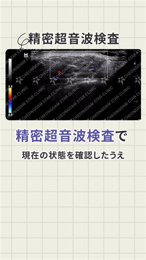 異物除去治療『すべて同じ施術方法』だと思ってないですか❓ #韓国美容 #韓国整形 #渡韓美容