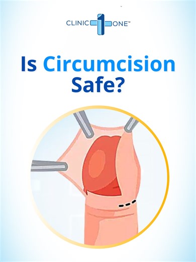 Thinking about circumcision? You might be asking: Is circumcision very painful? Is circumcision 100% safe? How much does circumcision cost? At Clinic One, get a safe, quick circumcision by trained doctors with minimal pain and proper care. 📍 Book now at Clinic One for professional and trusted care! Your Health First - Clinic One . . . . #ClinicOne #cliniconektm #cliniconelalitpur #cliniconekathmandu #cliniconebhaktapur #mensexualhealthproblems #mensexualhealthservice #MenSexualHealth #Circumcis