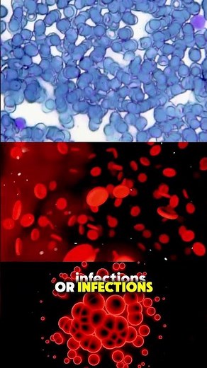 Bone Marrow Biopsy Explained (3D Animation) #3danimation #medicaleducation #healthcare #fyp