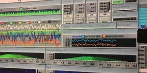 Neurotherapy can assist with brain function