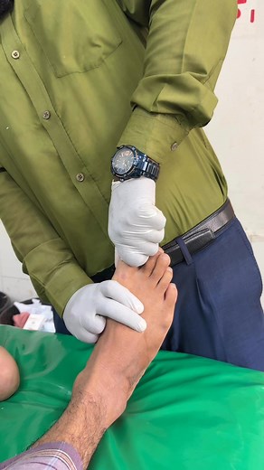 Thumb finger dislocation #dislocation #orthopedics | Md Ataurr Rahman