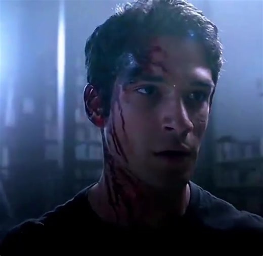 Scott McCall: The Rise of the True Alpha in Teen Wolf