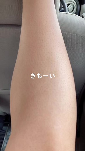 足の毛穴ケア方法とポツポツ治療の効果的なアイテム紹介