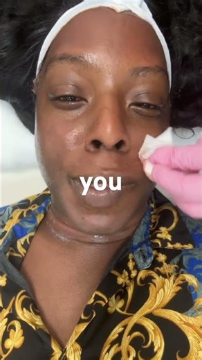 Bloody Forehead #botched #esthetician #skincareproducts laseraway #rejuran #skincare #skinpen