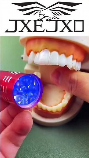 JXE JXO moldable plastic beads for tooth gap, fix missing tooth #missingtooth #tooth #filling