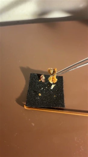 これは大きい…！！ #earcleaning #耳垢の除去 #耳かき