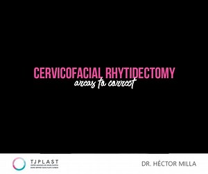 12 reactions | ✨CERVICOFACIAL RHYTIDECTOMY (FACELIFT) : AREAS TO CORRECT✨ . REAL CASES, REAL FACES . . #drhectormilla #tjplast #cirugiaplastica #plasticsurgery #ritidectomia #rhytidectomy #necklift #facelift #cervicofacialrhytidecotmy #ritidectomiacervicofacial ☎MEX (664) 634-6981 / 634-2367 ☎USA (619) 227-8242 / 606-4363 | Dr. Hector Milla - TjPlast | Facebook