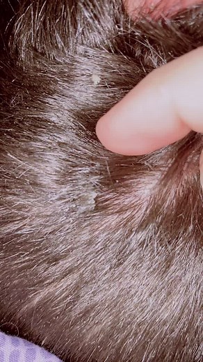 Satisfying Scab Removal: Get Bachelor Ready with My Routine