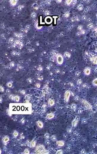 What’s Really Living in Your Sponge? Microscope Reveal