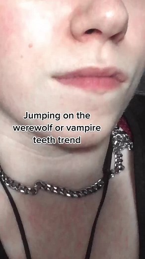 Exploring the Werewolf vs. Vampire Teeth Trend