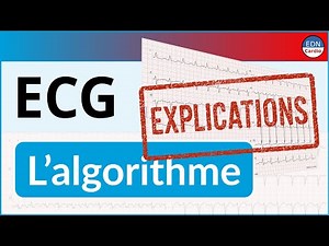 ECG Interpretation: EXPLANATIONS!