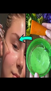 Anti aging homemade recipe - Remove wrinkles and fine lines instantly - natural botox #antiaging #wrinkles #skincare #beauty #botox | Simple Home Remedies