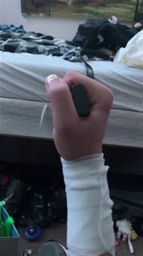 Day 7 of post ORIF recovery, 1 week in!!!