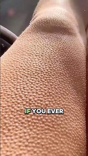 If You See This on Your Skin, Seek Help Immediately!