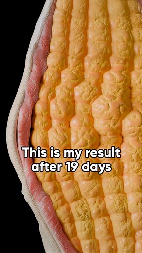 Minimize PCOS symptoms with our program | PCOS Tracker | Facebook