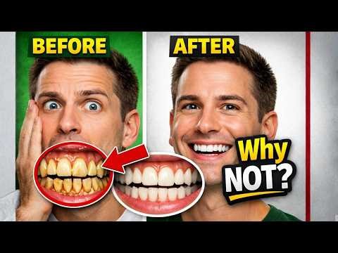 BEST Remedy for Dental Plaque (TARTAR) You Will Regret day That You do Not Use the Method! Works