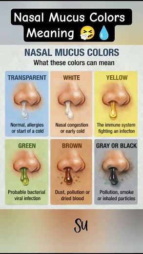Nasal Mucus Colors Meaning 🤧💧 | What Your Snot Says About Health 😱 #shorts