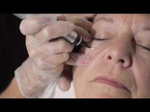 CryoProbe - Medical Treatments